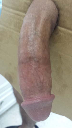 hungdirk9 Picture