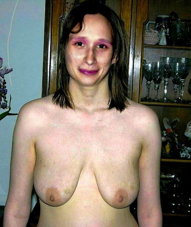 Teen with Saggy Tit