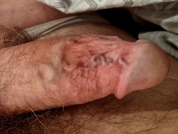 The squiggly group of veins are where my orgasms start.