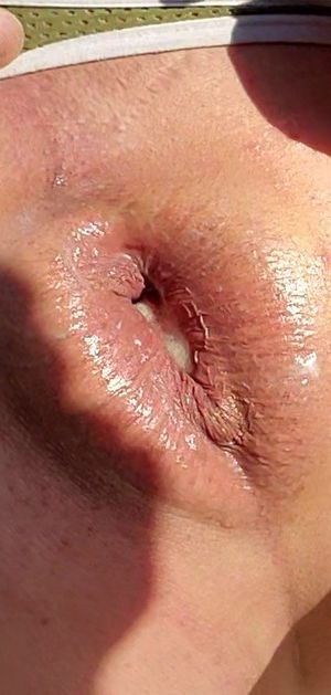 Gape close up 9