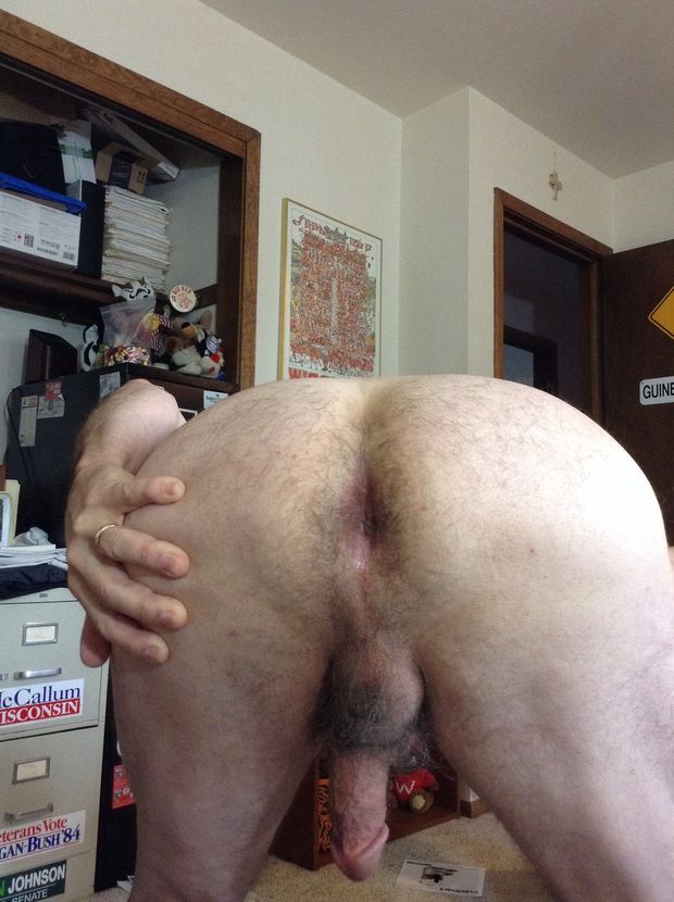 My asshole