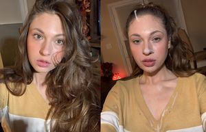 before and after facial