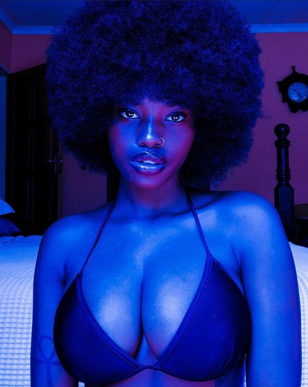 melanin