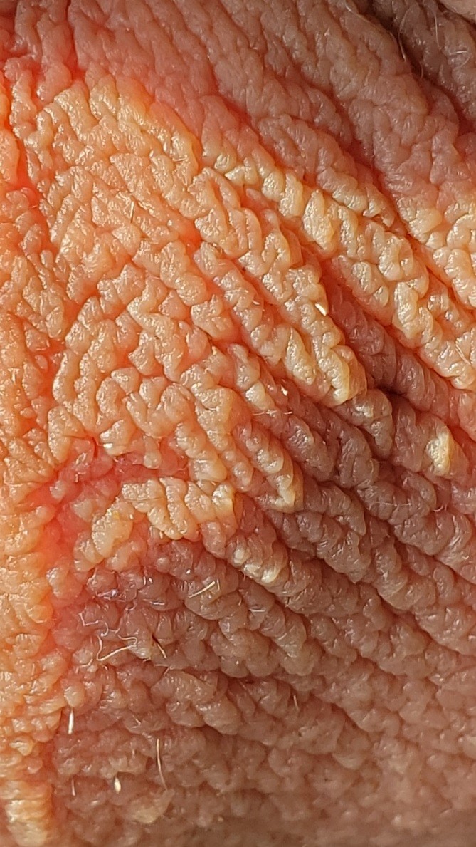 A look at my scrotum
