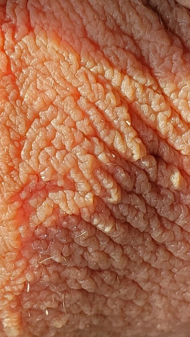 A look at my scrotum