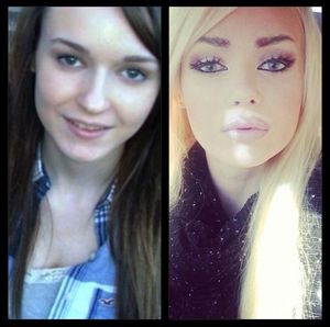 Bimbofication project. Improved with bleached hair, lip filler, appropriate presentation & attitude