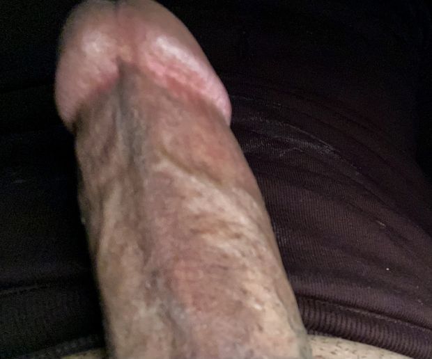 Sex