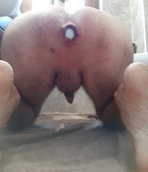My anal open