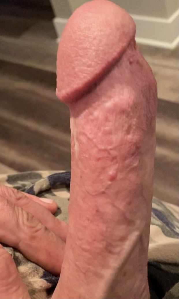 Hard cock