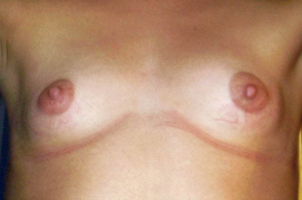 Petits seins 2