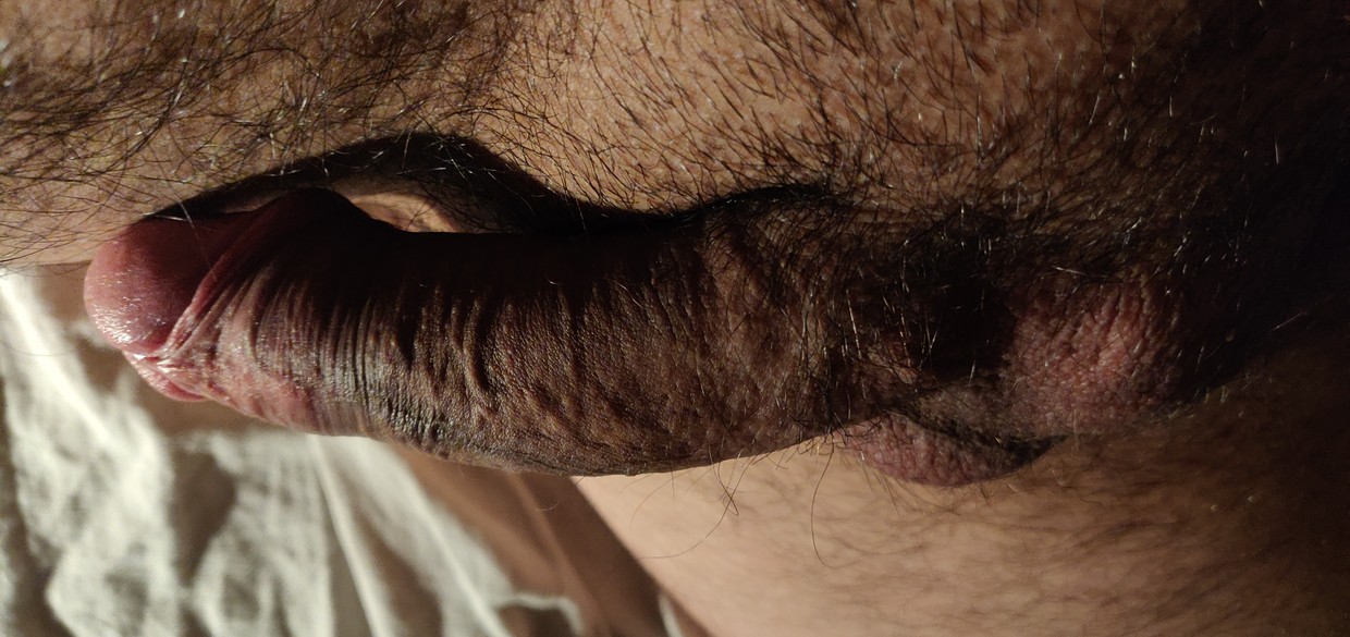 Edging