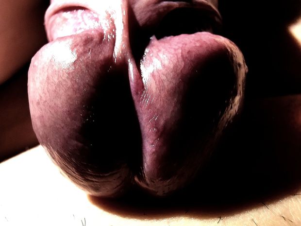 Strawberry head