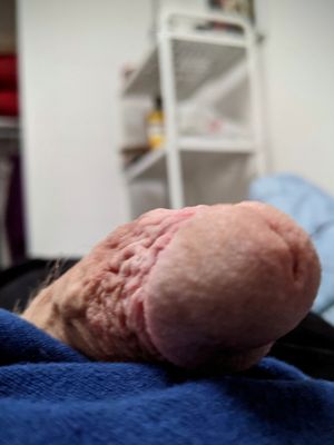 I love how it focused on the veins.