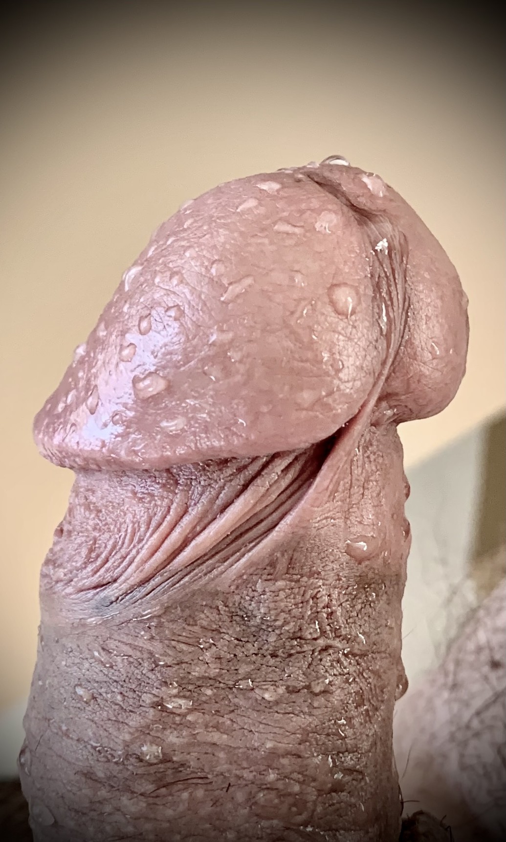 Wet head