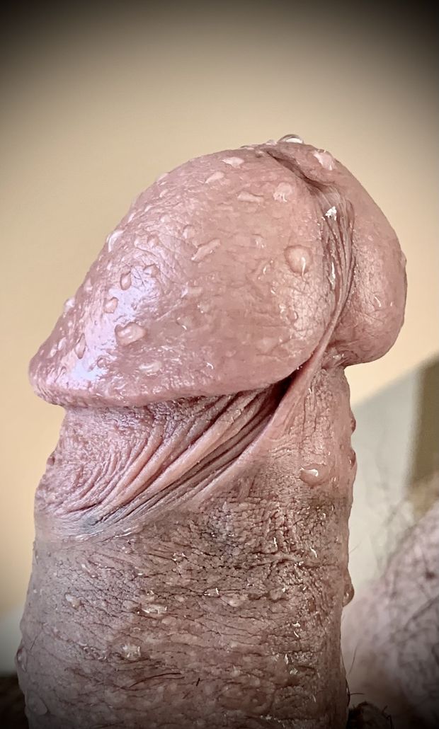 Wet head