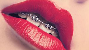 Sexy Mouth With Braces
