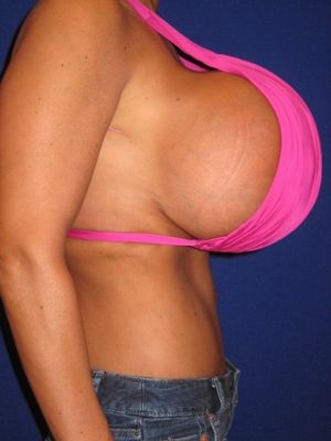 HUGE TITS CAUSE LOWER BACK PAIN!