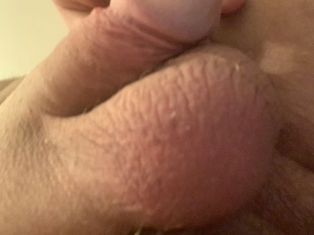 Cute hairless package never grew