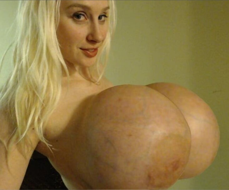 32-34KK Kristi is eg of beautiful pretty face,  ruins it with retarded fake tits. Not attractive!