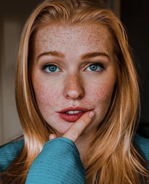 Kiss my freckles