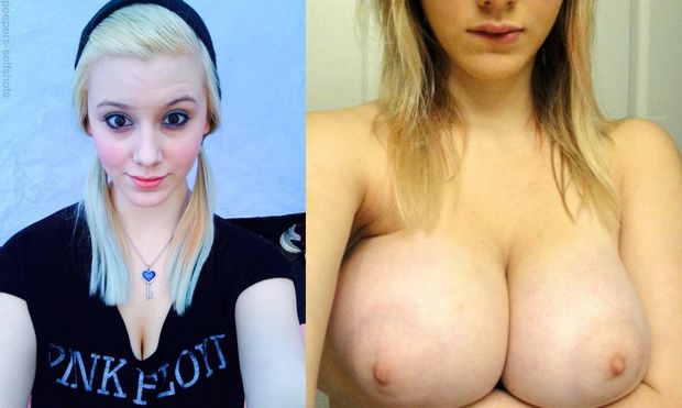 before after