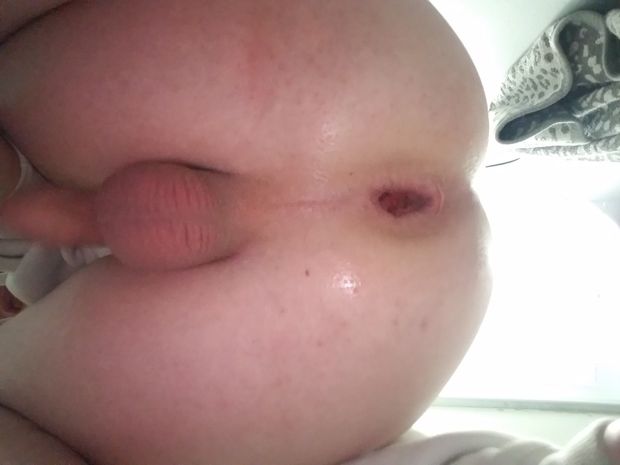 Gaping ass