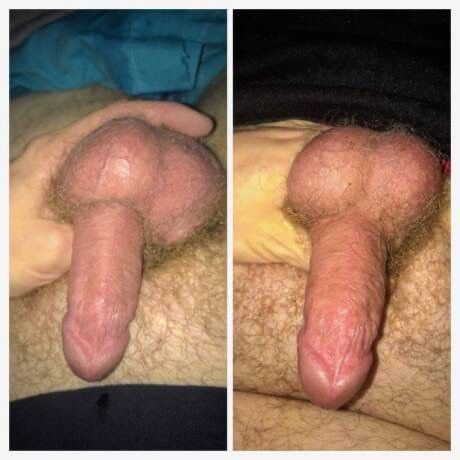 Two pics of my dick that look similar taken months apart.