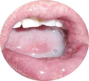 Mandalox91x Picture
