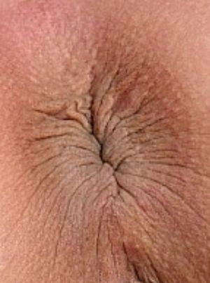 Mmmm.... (Close-Up of Charlotte’s Anus)