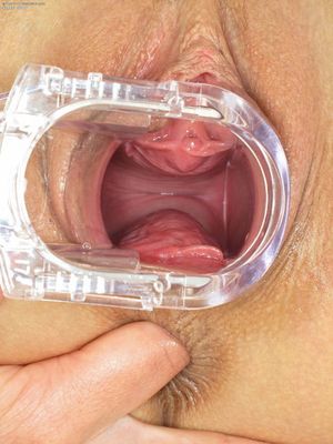 Speculum in pussy and finger in ass