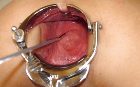 Poking around inside her anus