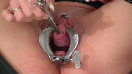 A toy in her pee hole