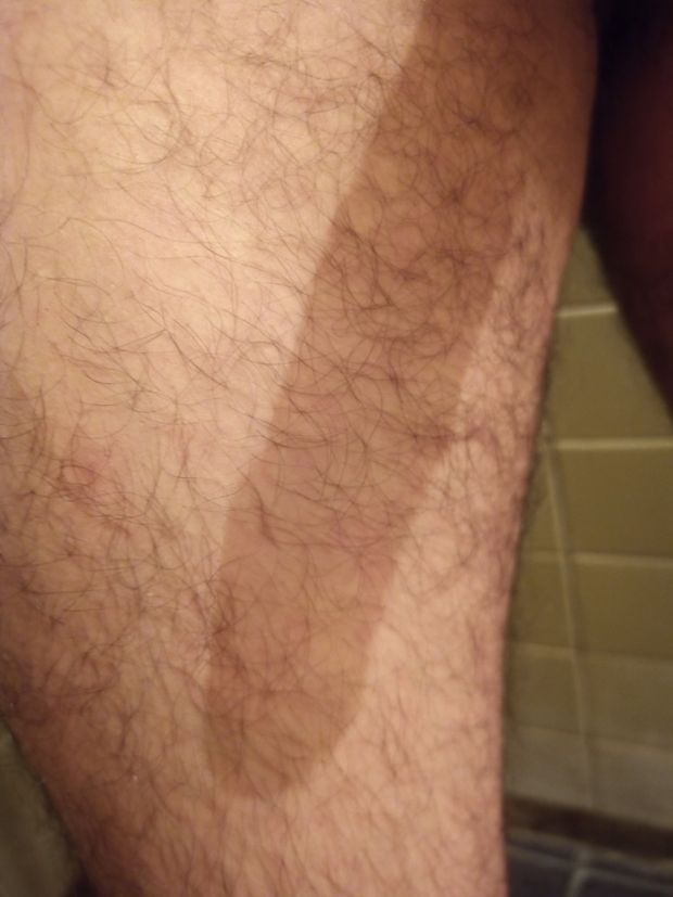 Mi pene