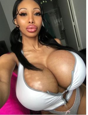 SILICONE PACKED TITS!