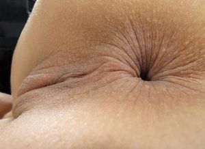 Anal wrinkles