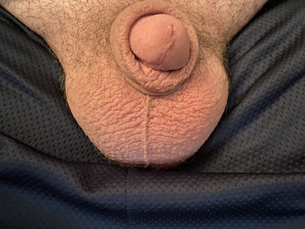 micropenis “button dick” sticks straight out