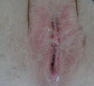 Hole used by another cock, he deposited inside and out