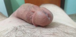 Precum after getting waxed