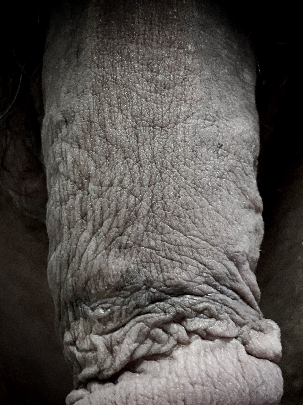 Wrinkly dick