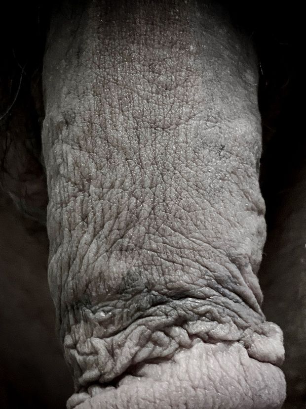 Wrinkly dick