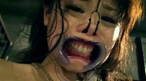 dental gag and nose hook