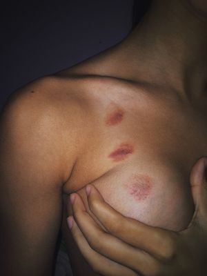 And I'm not supposed to ask about these?