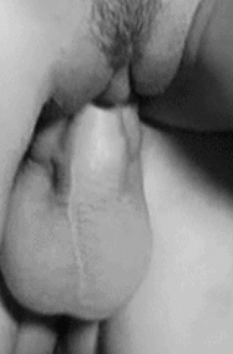 Erotic Sex Pics | إثارة وشبق بلا قيود