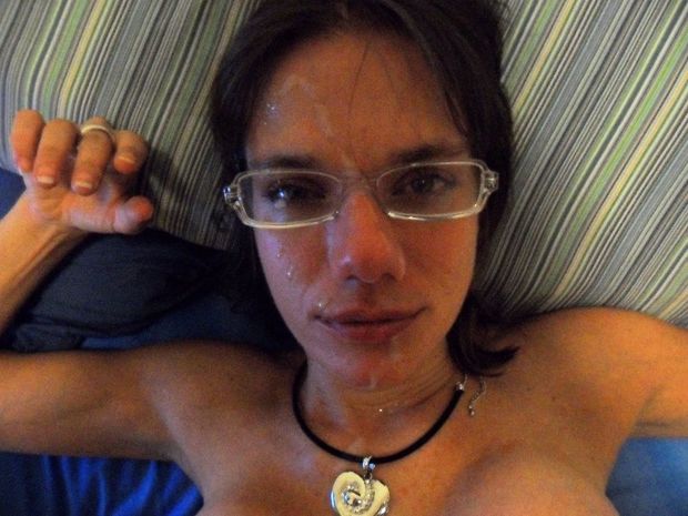 Post facial