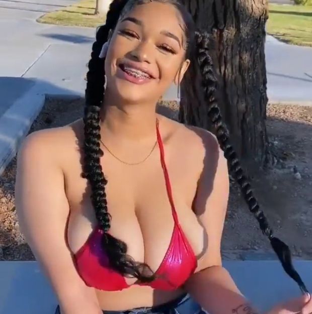 Lexie braces pigtails