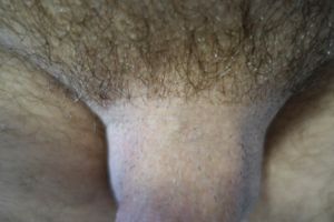 half hairy man pubis #