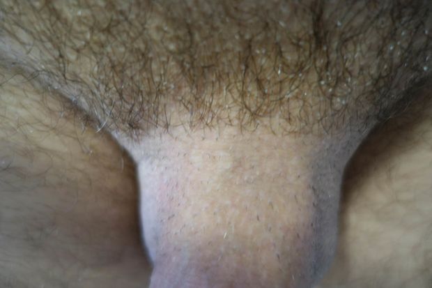 half hairy man pubis  #