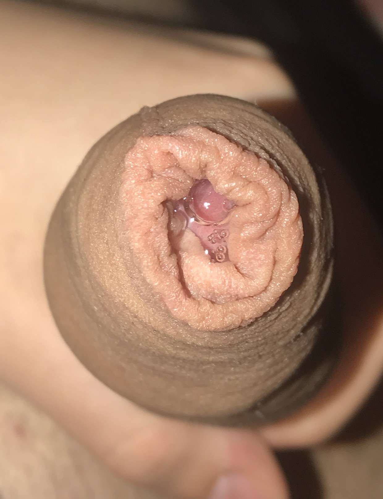 Foreskin closeup