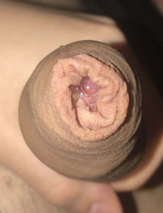 Foreskin closeup