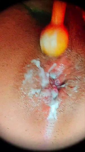 Slime came out of my ass